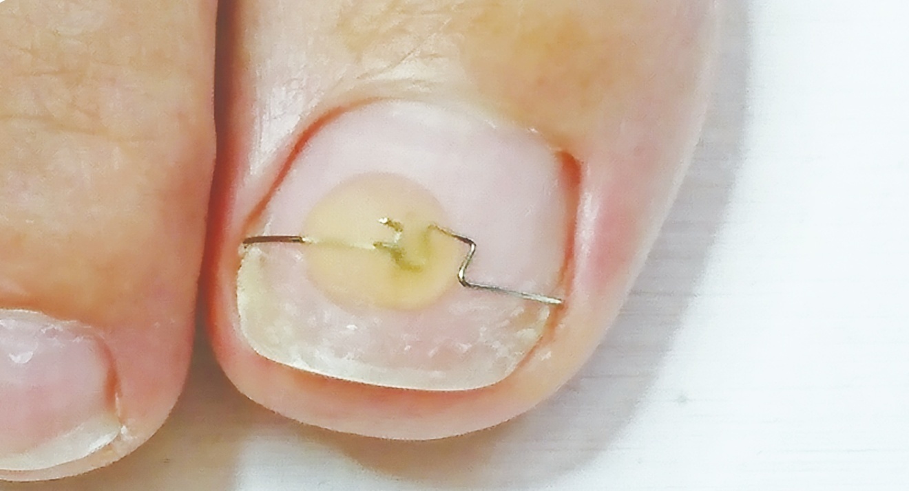 まちの樹鍼灸整骨院