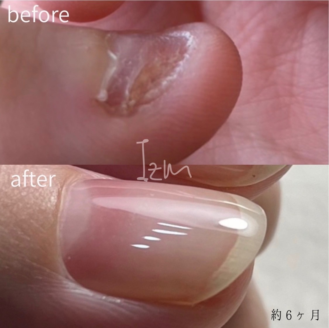 深爪矯正・自爪育成ネイルサロンIzm