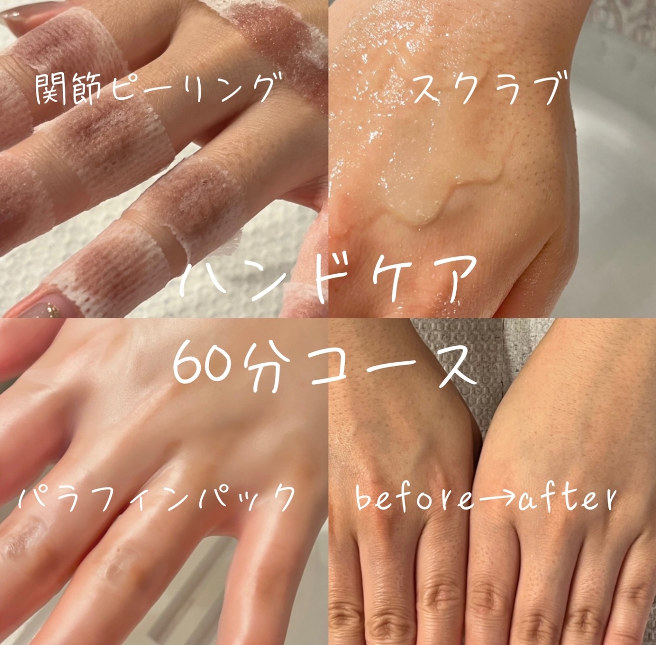 深爪矯正・自爪育成ネイルサロンIzm