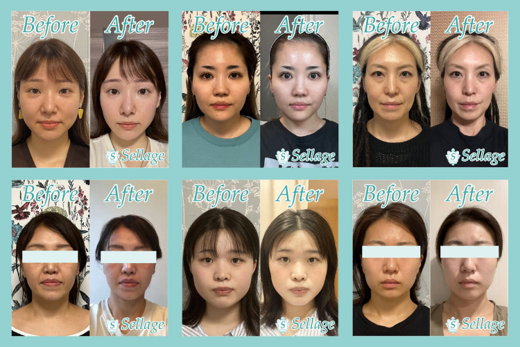 小顔＆頭皮リリースセラージュ大阪市北堀江