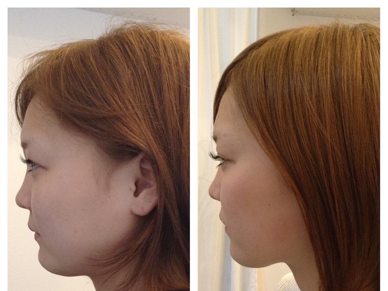 けんぴの美容整体＆小顔矯正【富士市】