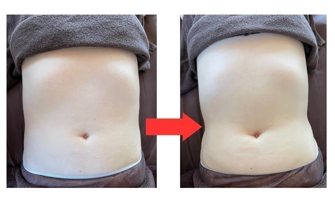 ハッピーアロマ/山口県/不調の根本改善