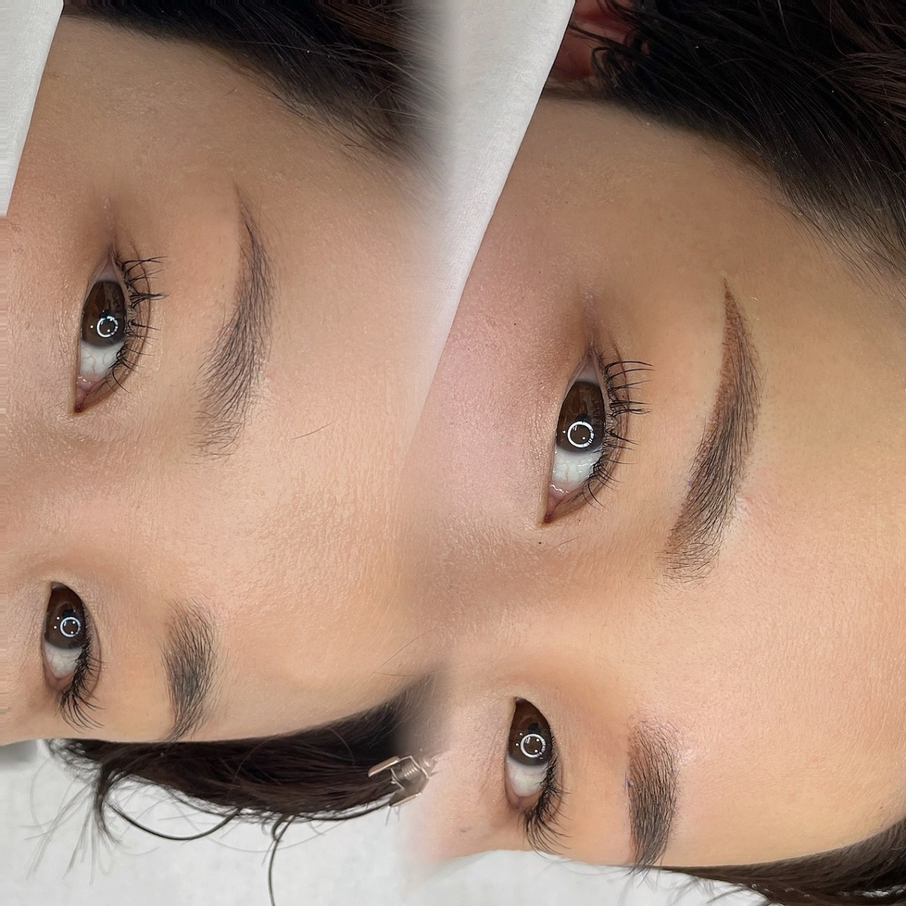 Bx clinic osaka 心斎橋