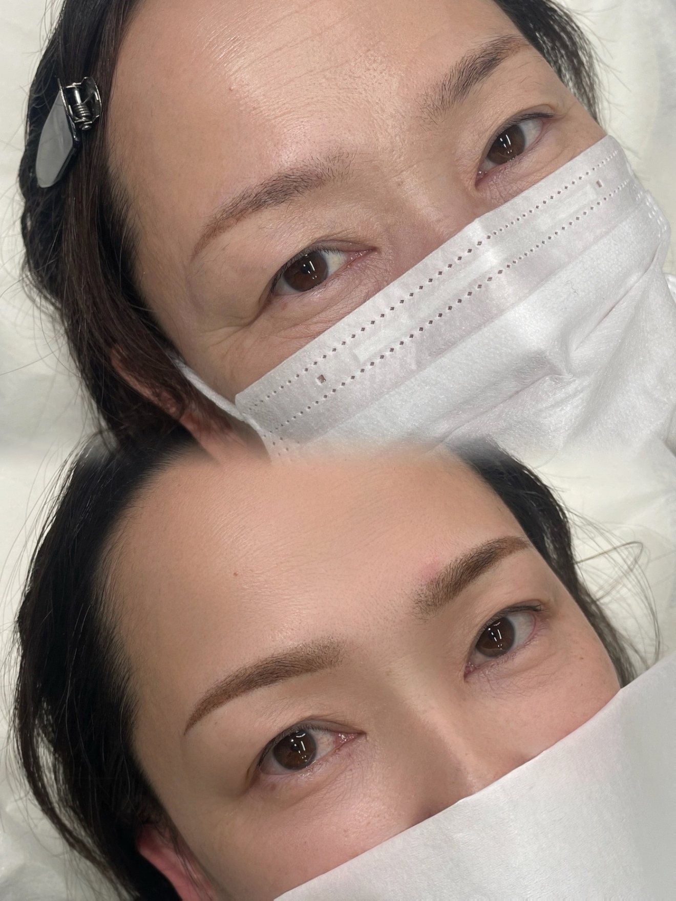 Bx clinic osaka 心斎橋