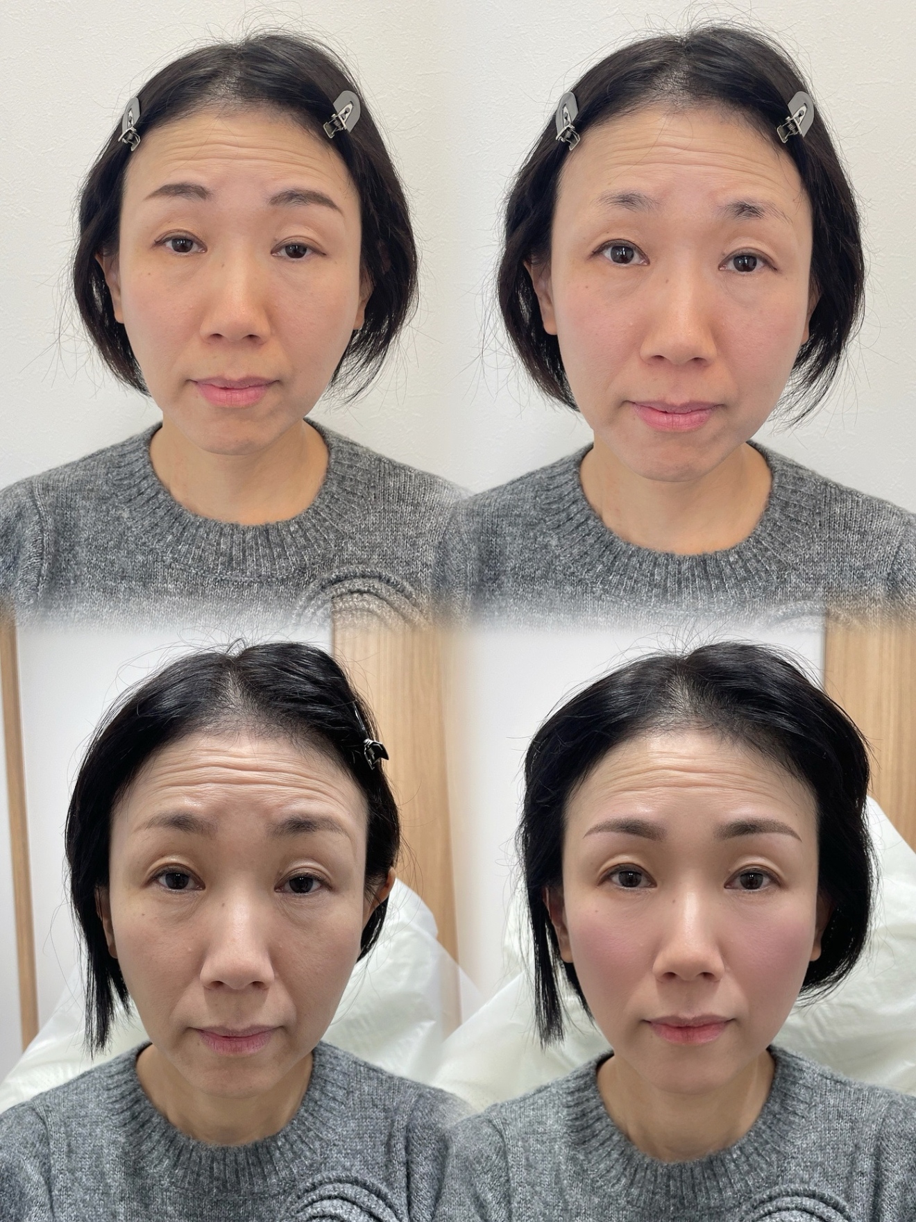 Bx clinic osaka 心斎橋