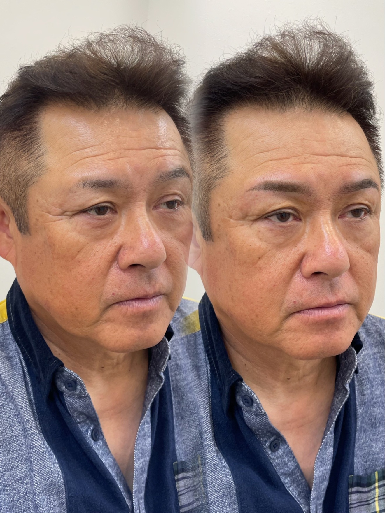 Bx clinic osaka 心斎橋