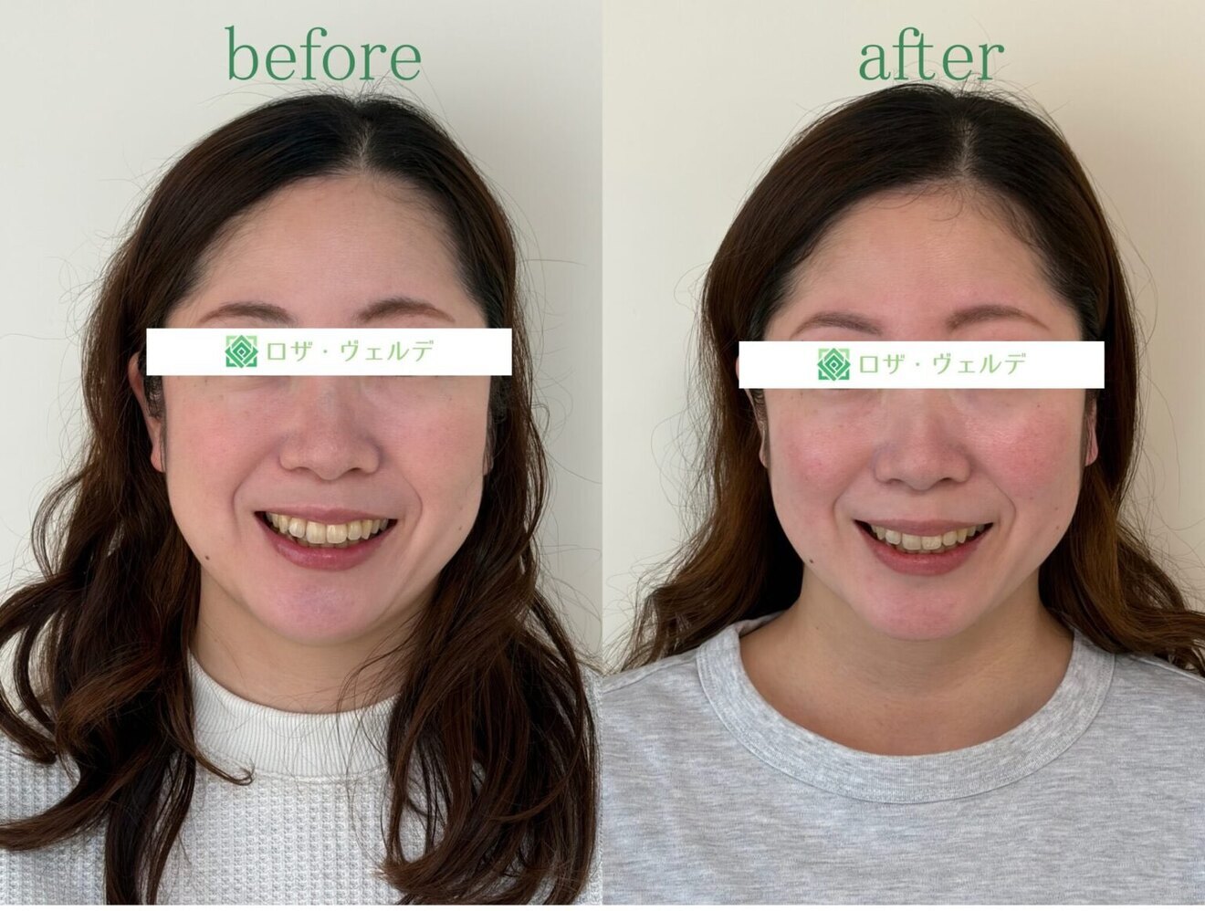 🌿小顔矯正サロン/ロザ・ヴェルデ
