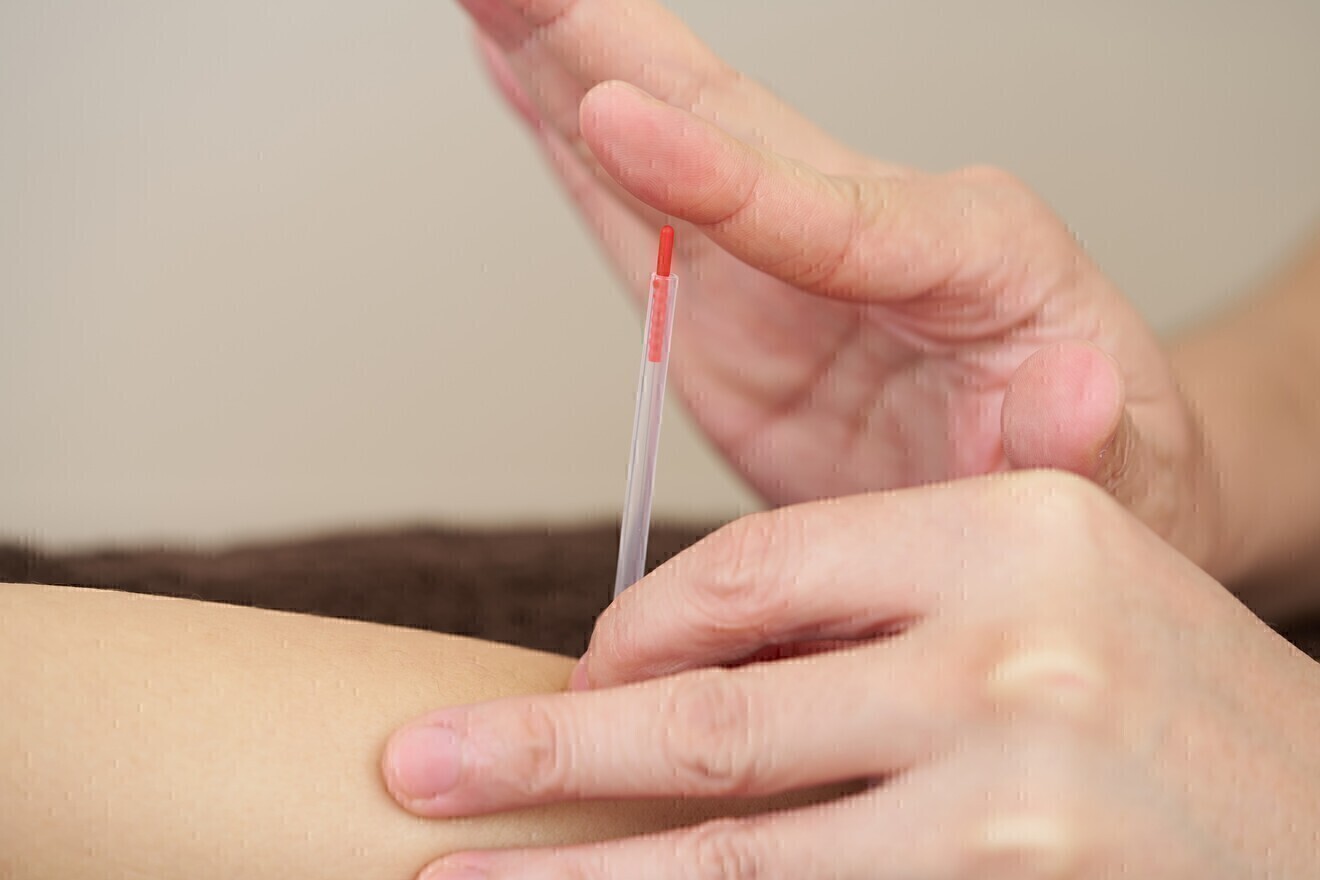 恵比寿鍼灸院ハリステーション/代官山渋谷