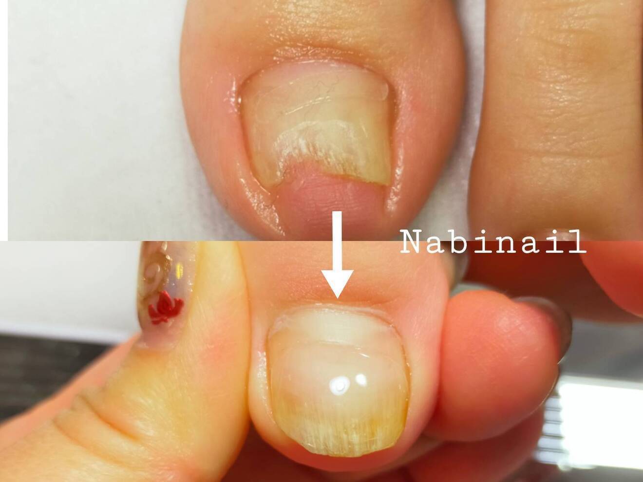 Nabinail / 西日暮里•新三河島