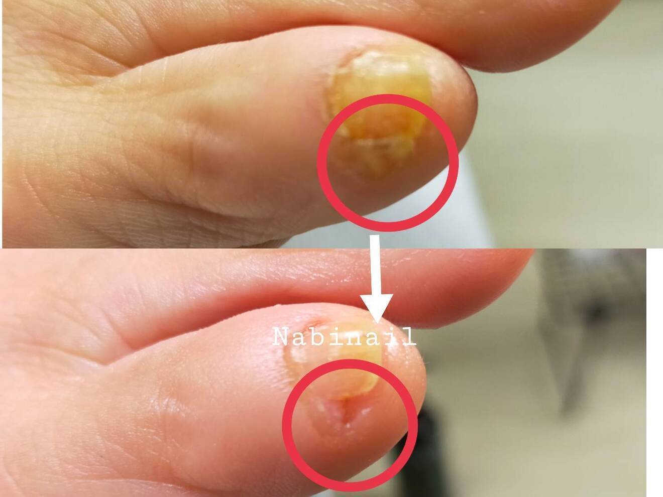 Nabinail / 西日暮里•新三河島