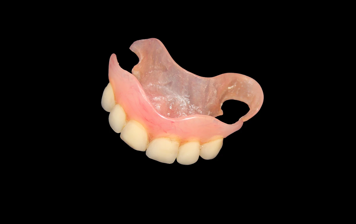 Clinical photo of a hand-crafted flexible denture showing natural gum shading and tooth symmetry.