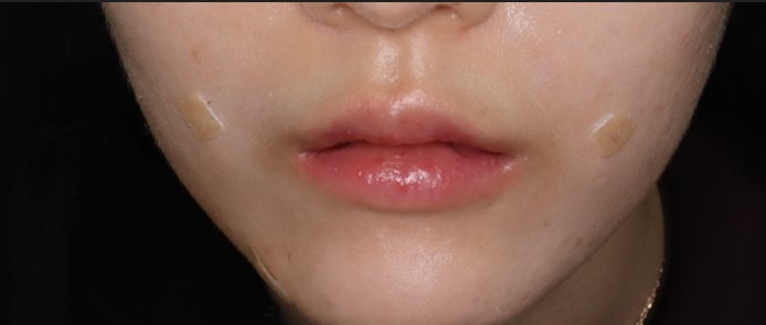 after image