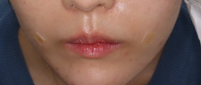 before image