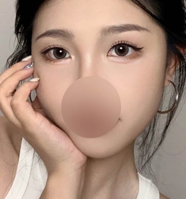 after image