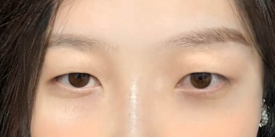before image