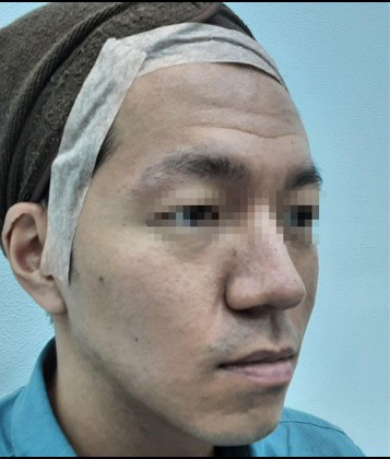 before image