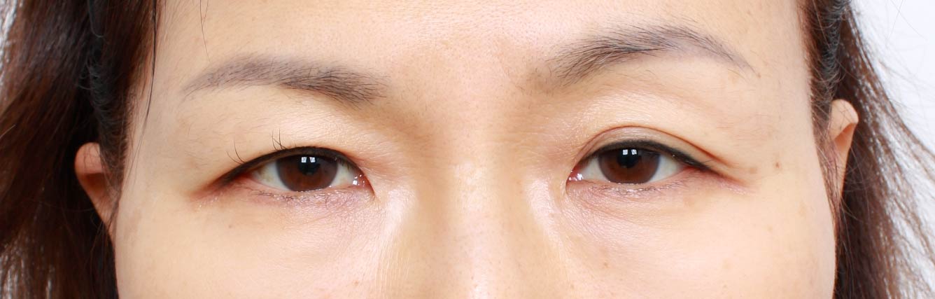 before image