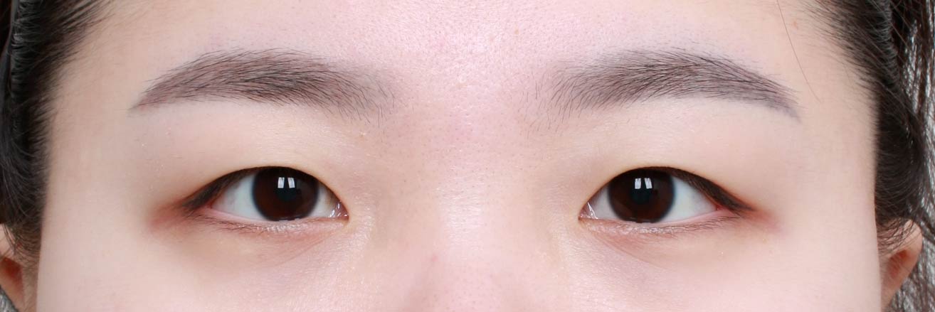 before image