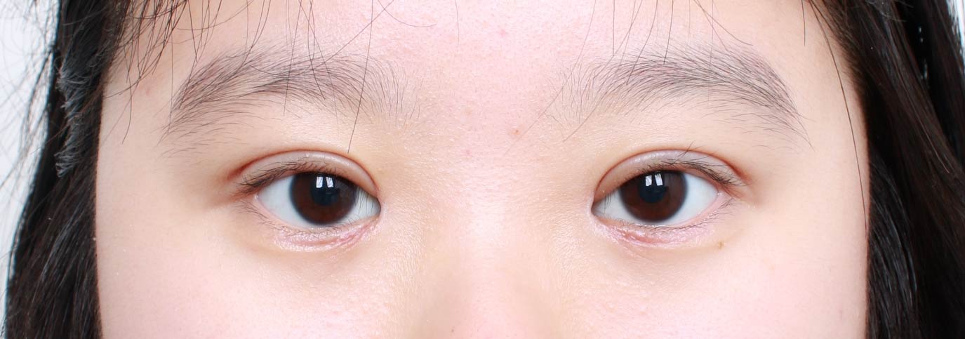 after image