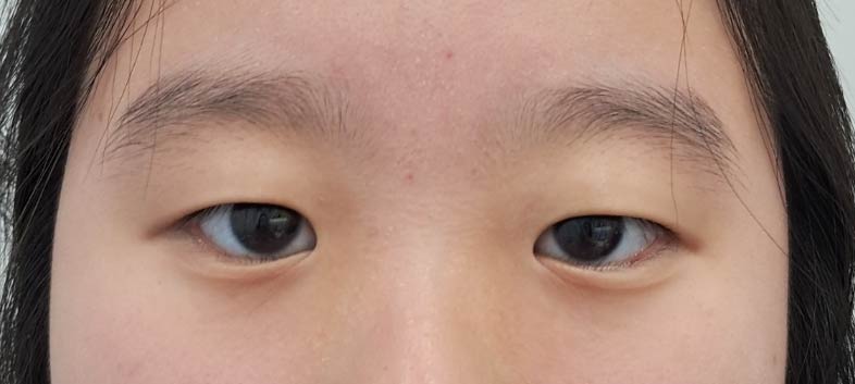 before image