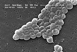 Bacteria del acinetobacter baumannii. Foto: Wikipedia.