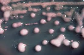 La bacteria del Klebsiella-pneumoniae es una de las más peligrosas. Foto: Wikipedia.