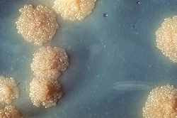 Lethal Bacteria. Photo: Wikipedia.