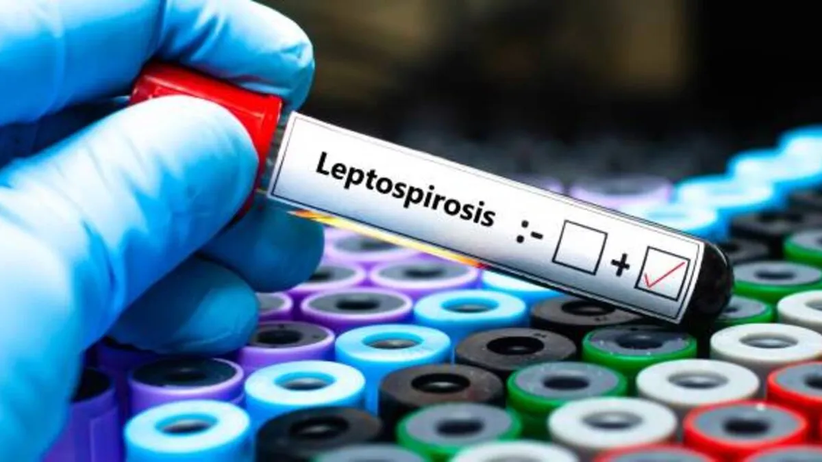 casos de leptospirosis