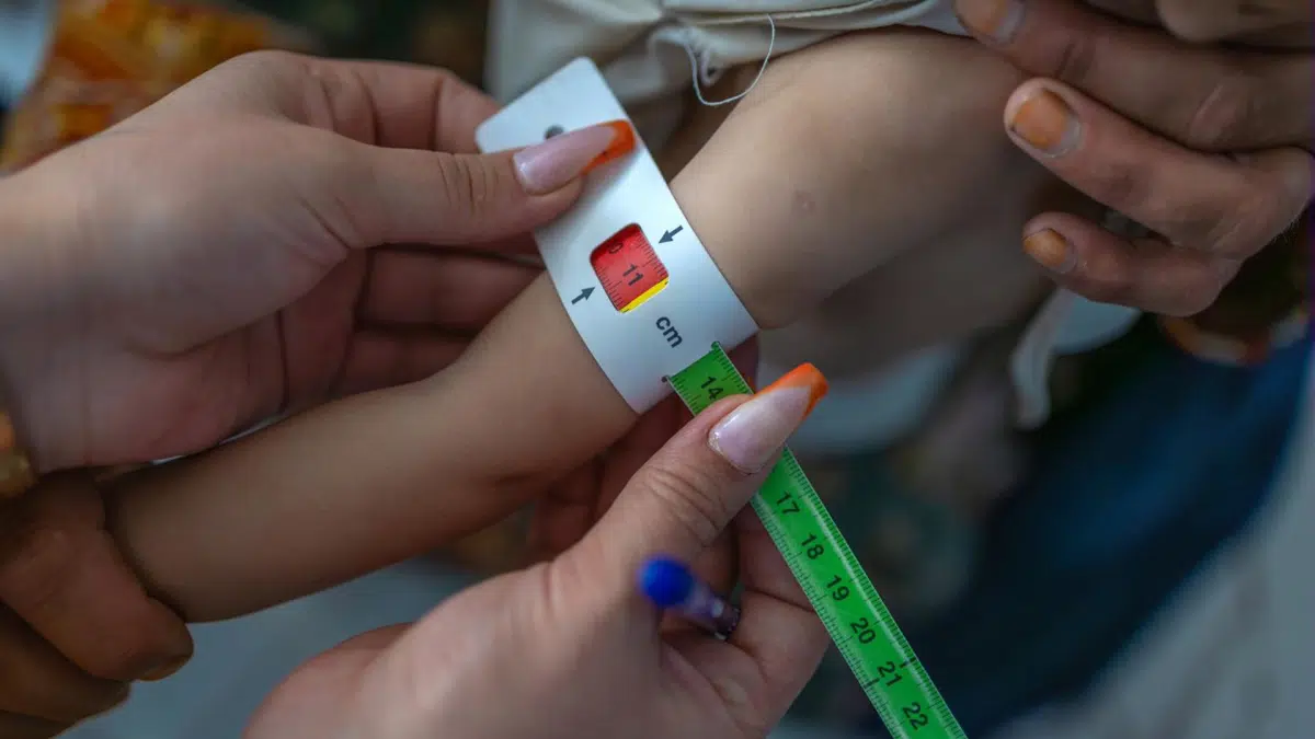 An alarming outlook in Afghanistan: 3.7 million children at risk of malnutrition due to food insecurity