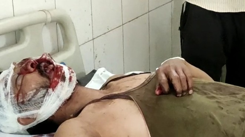 Attack on Journalist