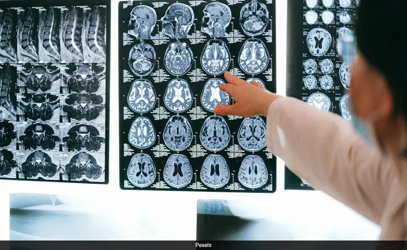 Brain-Computer Interface: Tech ka Kamal ya Khatron ka Signal?