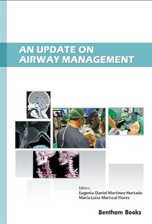 An Update on Airway Management PDF