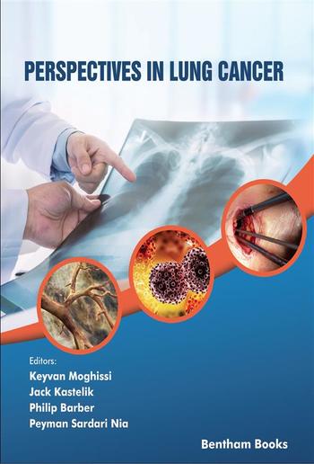 Perspectives in Lung Cancer PDF