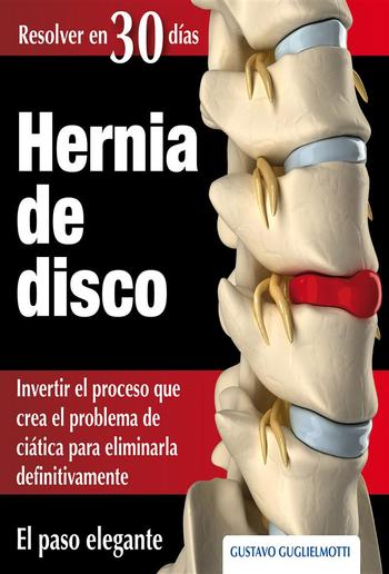 Hernia de disco - cerrar sin cirugía PDF