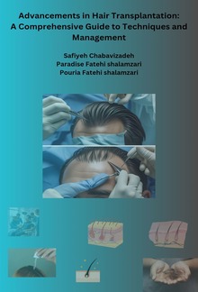 Advancements in Hair Transplantation: A Comprehensive Guide to Techniques and Management PDF