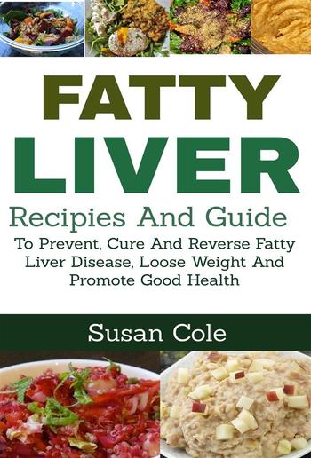 Fatty Liver PDF