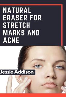 Natural Eraser for Stretch Marks and Acne PDF