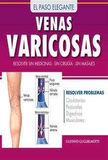 Venas Varicosas - Solución definitiva PDF