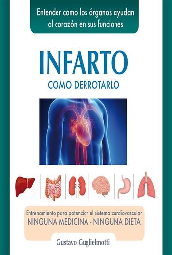 Infarto PDF