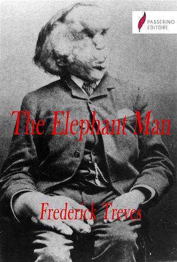 The Elephant Man PDF