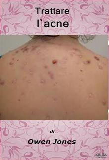 Trattare L'Acne PDF