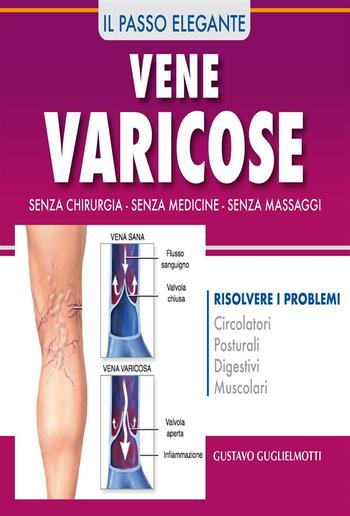 Vene varicose - Prevenire, ridurre ed eliminare PDF