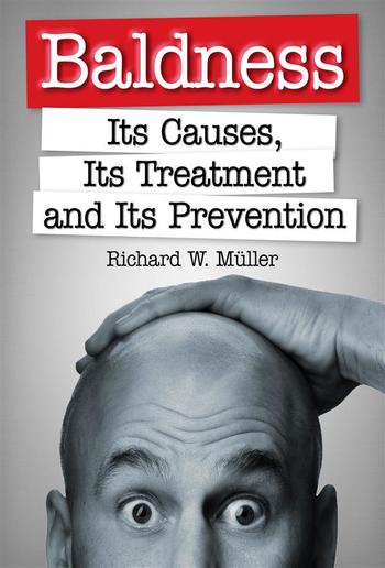 Baldness - Its Causes, Its Treatment and Its Prevention PDF