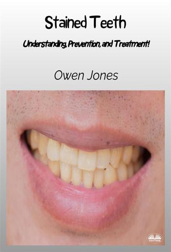 Stained Teeth PDF