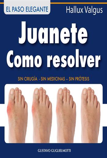 Juanete - Resolver sin cirugía PDF