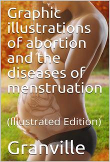 Graphic illustrations of abortion and the diseases of menstruation PDF