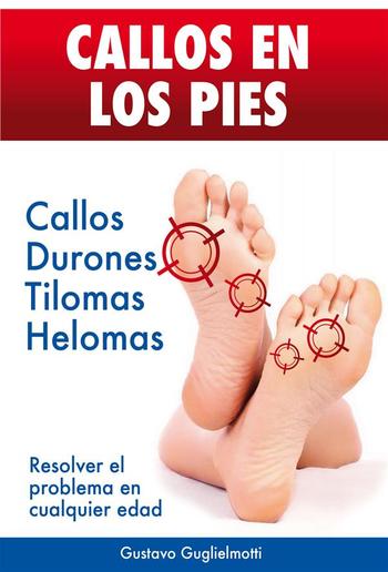 CALLOS EN LOS PIES - Solución definitiva para Callos, Tilomas y Helomas. PDF