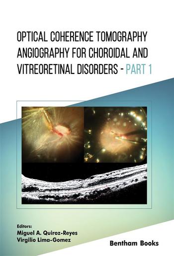 Optical Coherence Tomography Angiography for Choroidal and Vitreoretinal Disorders – Part 1 PDF