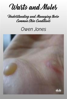 Warts And Moles PDF