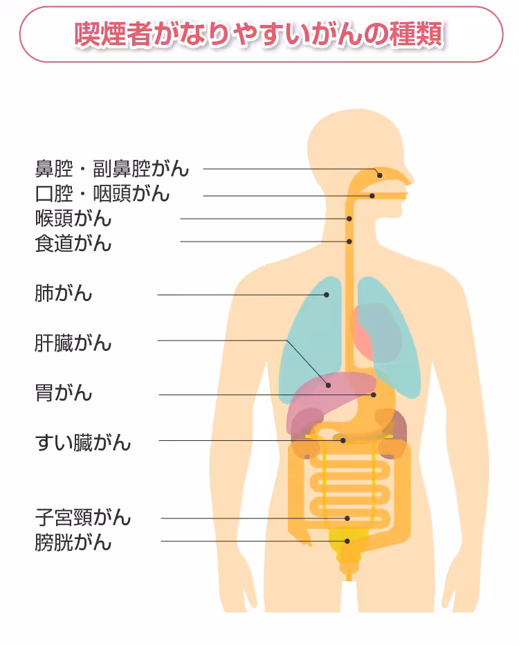 タバコ タールって何？ – タバコ タール 種類 – タール – EJWDT
